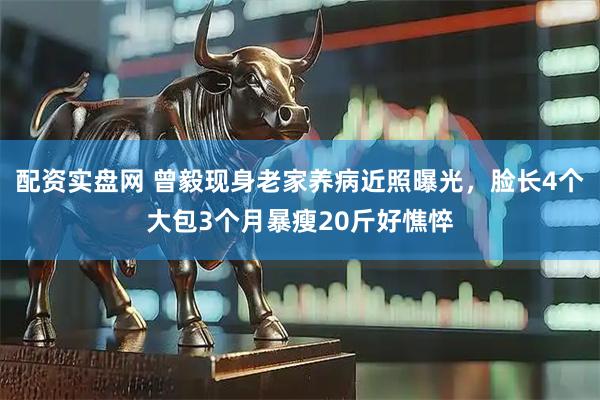 配资实盘网 曾毅现身老家养病近照曝光，脸长4个大包3个月暴瘦20斤好憔悴